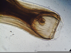 Strongylus Vulgaris Image