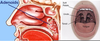 Adenoids Nose Image