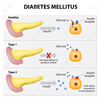 Juvenile Diabetes Clipart Image