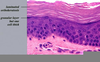 Ichthyosis Vulgaris Histology Image