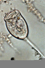 Vorticella Slide Labeled Image