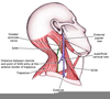 Vagus Nerve Palsy Image