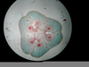 Ovary Slide Image