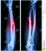 Clipart Of Forearm Image