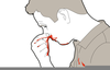 Choking Hazard Clipart Image