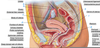 Uterine Ligaments Netters Image