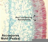 Peziza Labeled Ascus Image