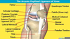 Medial Arcuate Ligament Image