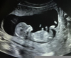 Ultrasound Doctor Clipart Image