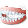 Denture 16 Image