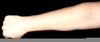 Forearm Drawing Image