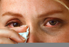 Raccoon Eyes Allergy Image