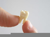 Pulled Tooth Molar Image