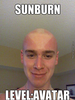 Funny Sunburn Meme Image