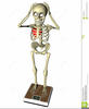 Anorexia Clipart Image