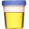 Urine Chamber Image