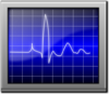 Ekg Monitoring Clip Art